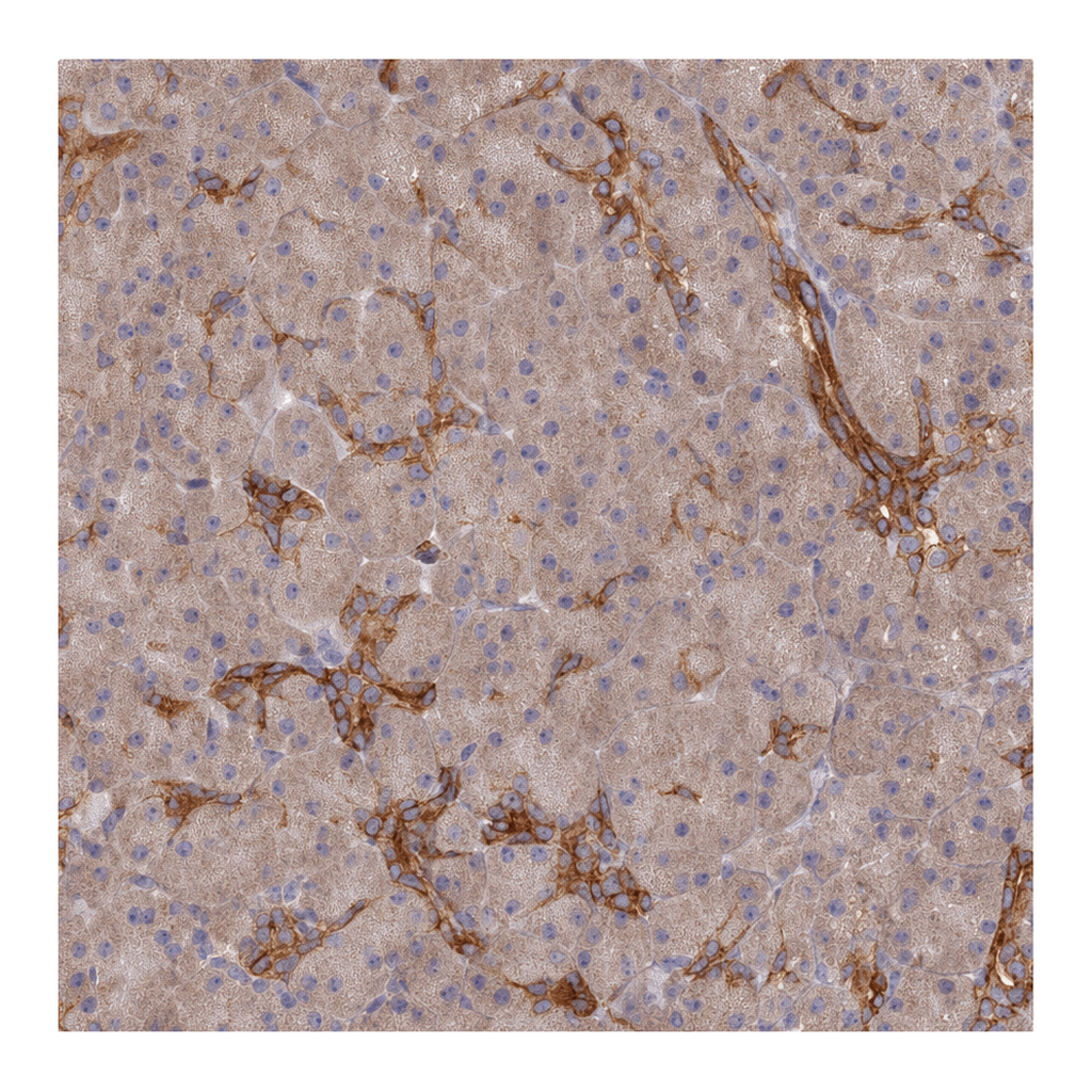 Atlas Antibodies Anti-ARRDC1 Antibody