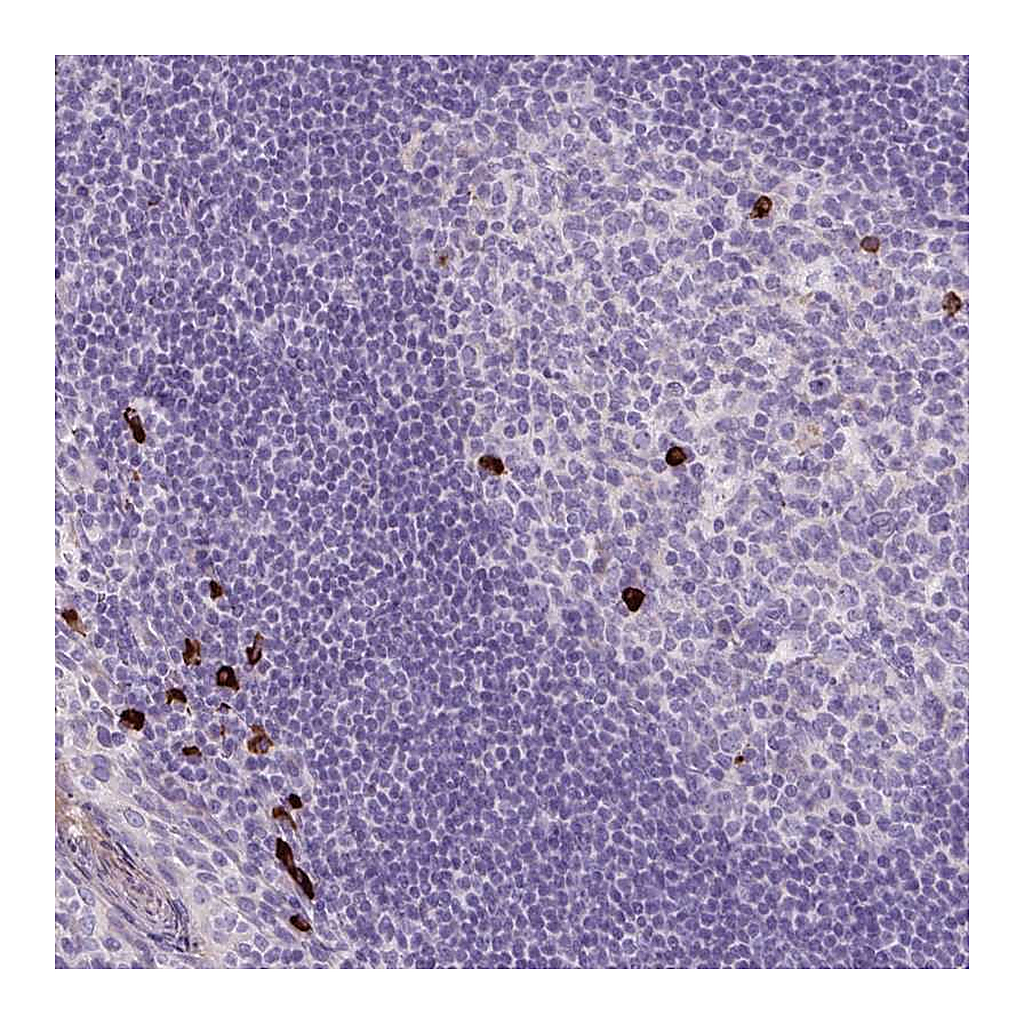 Atlas Antibodies Anti-ARRDC2 Antibody