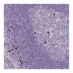 Atlas Antibodies Anti-ARRDC2 Antibody