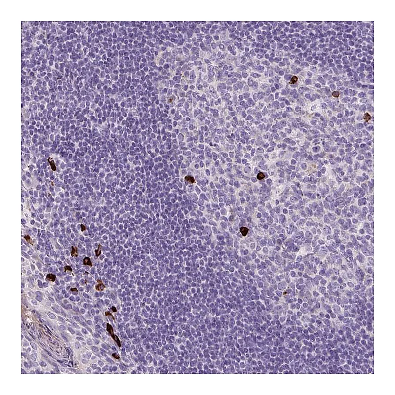 Atlas Antibodies Anti-ARRDC2 Antibody