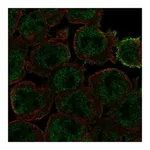 Atlas Antibodies Anti-ARRB2 Antibody