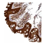 Atlas Antibodies Anti-ARRDC4 Antibody