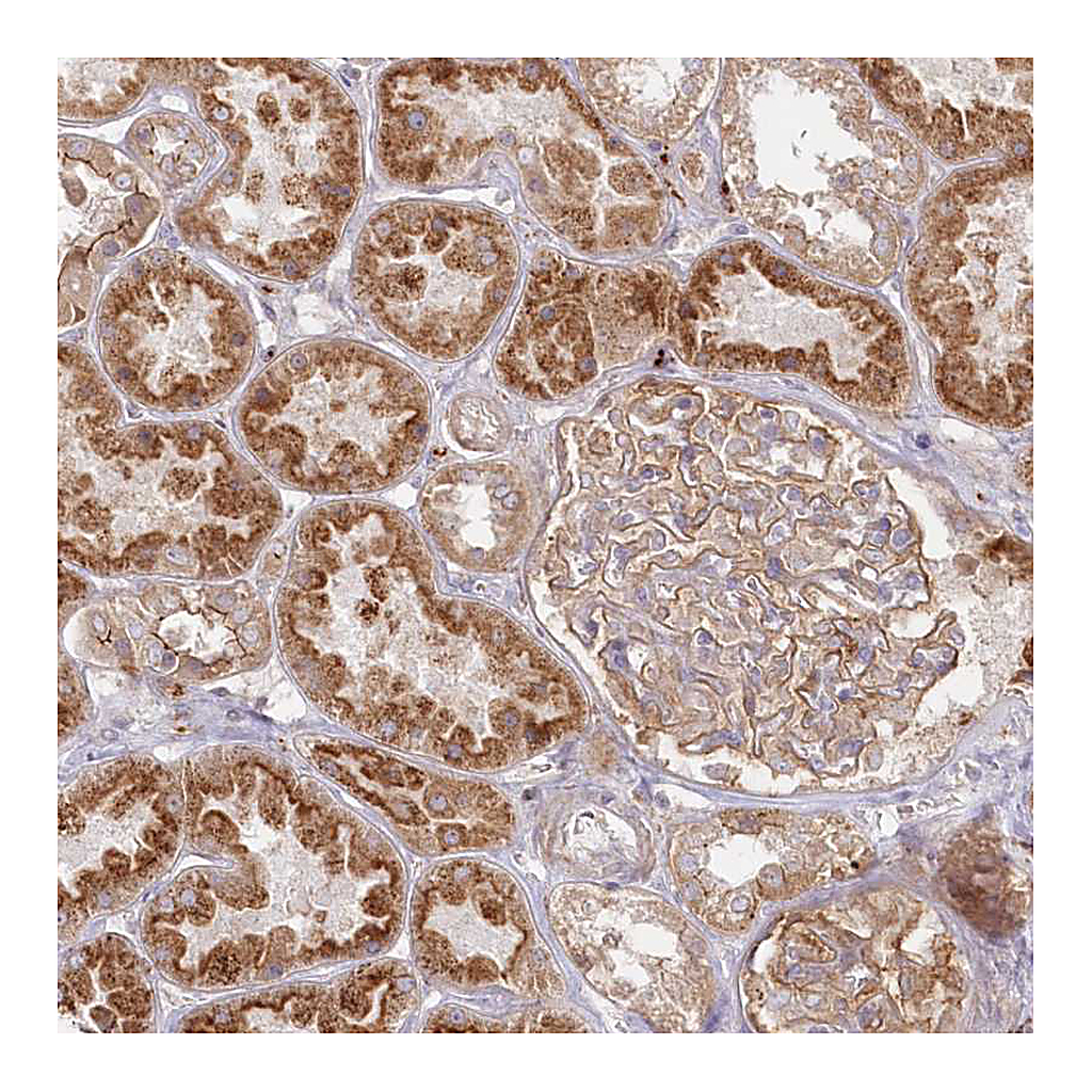 Atlas Antibodies Anti-ARSB Antibody