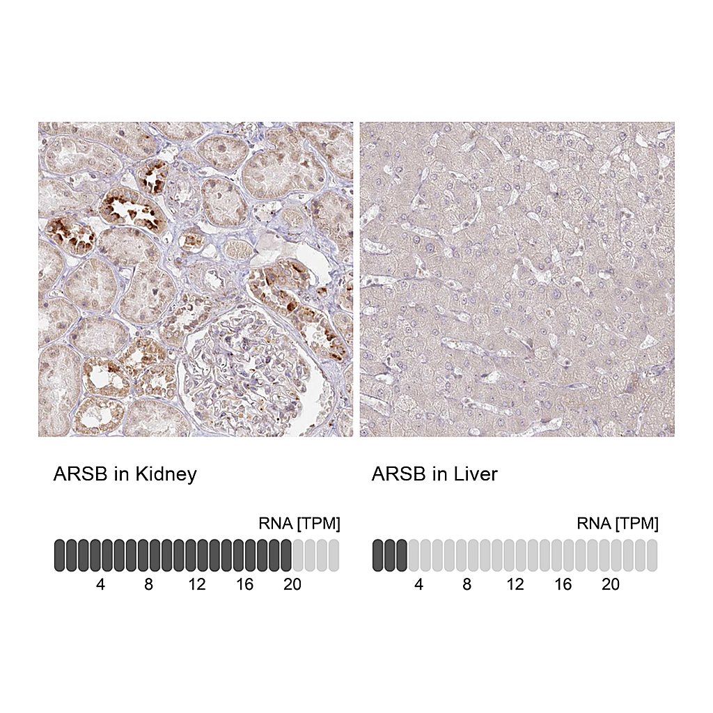 Atlas Antibodies Anti-ARSB Antibody