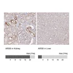 Atlas Antibodies Anti-ARSB Antibody