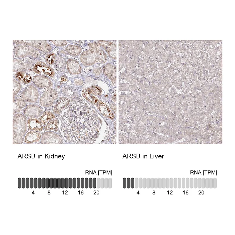 Atlas Antibodies Anti-ARSB Antibody