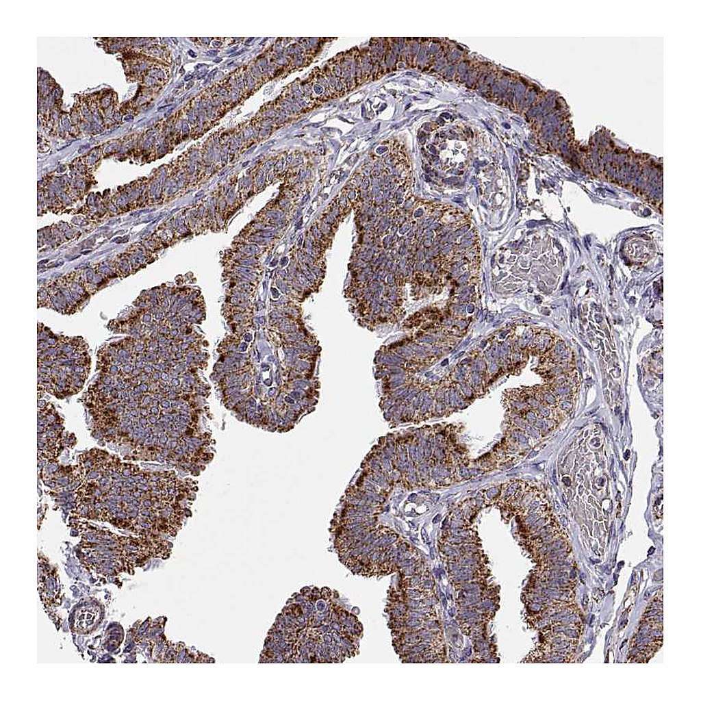 Atlas Antibodies Anti-ARSD Antibody