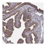 Atlas Antibodies Anti-ARSD Antibody