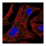 Atlas Antibodies Anti-ARSD Antibody