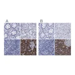 Atlas Antibodies Anti-ARSG Antibody