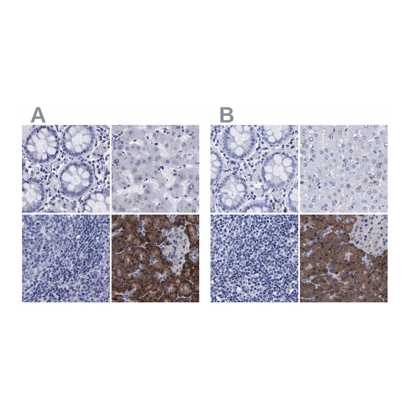 Atlas Antibodies Anti-ARSG Antibody