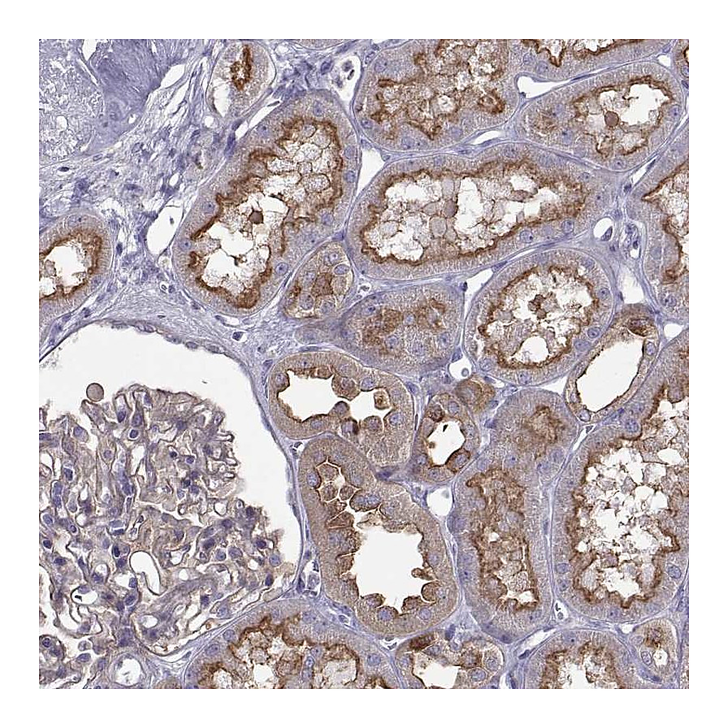 Atlas Antibodies Anti-ARSE Antibody