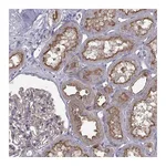 Atlas Antibodies Anti-ARSE Antibody