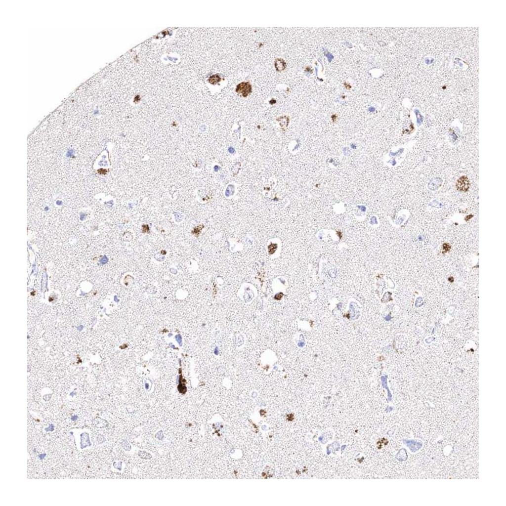 Atlas Antibodies Anti-ARSI Antibody