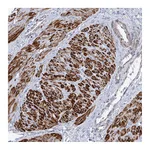 Atlas Antibodies Anti-ARSI Antibody