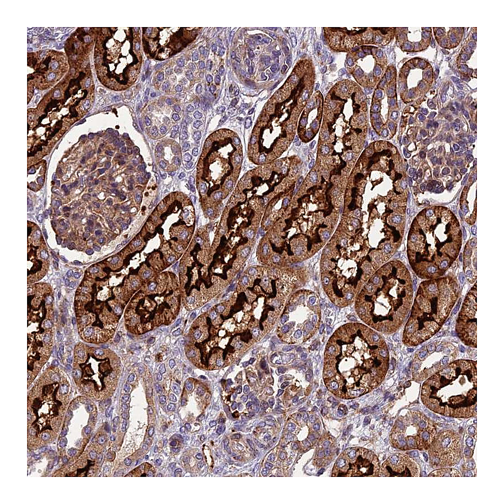 Atlas Antibodies Anti-ARSK Antibody