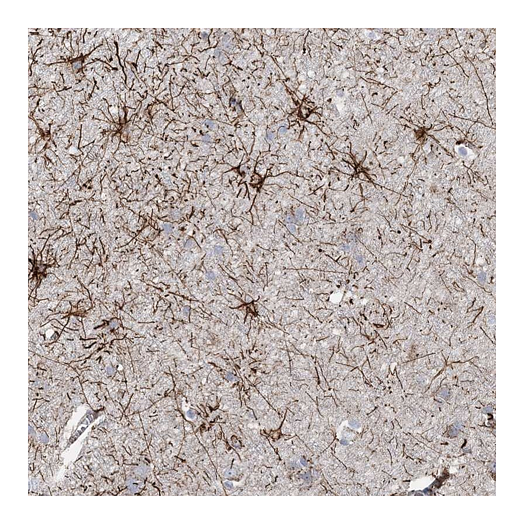 Atlas Antibodies Anti-ARSJ Antibody