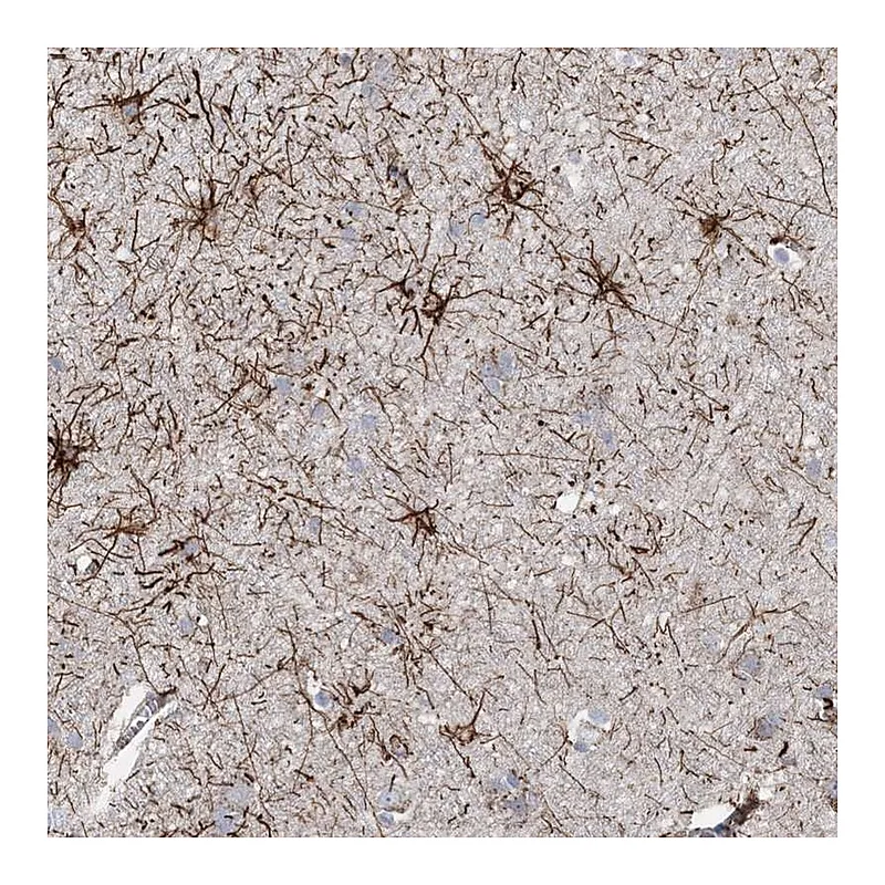 Atlas Antibodies Anti-ARSJ Antibody