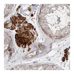 Atlas Antibodies Anti-ARV1 Antibody