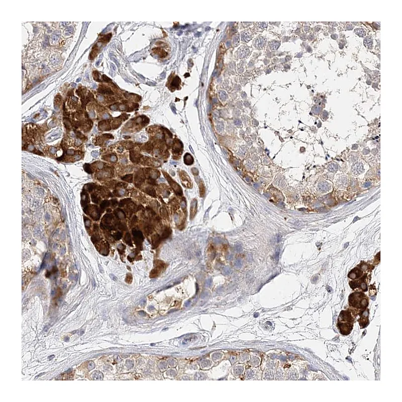 Atlas Antibodies Anti-ARV1 Antibody