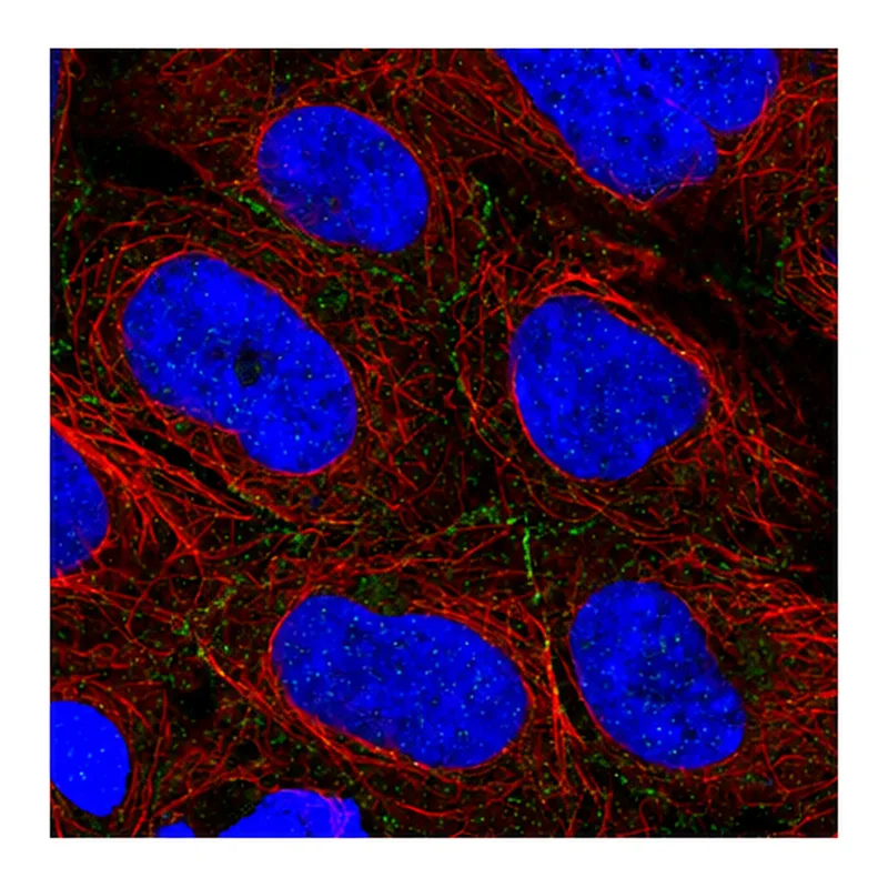 Atlas Antibodies Anti-ARVCF Antibody