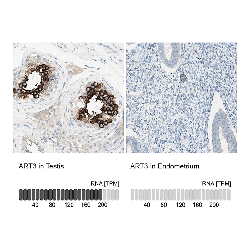 Atlas Antibodies Anti-ART3 Antibody
