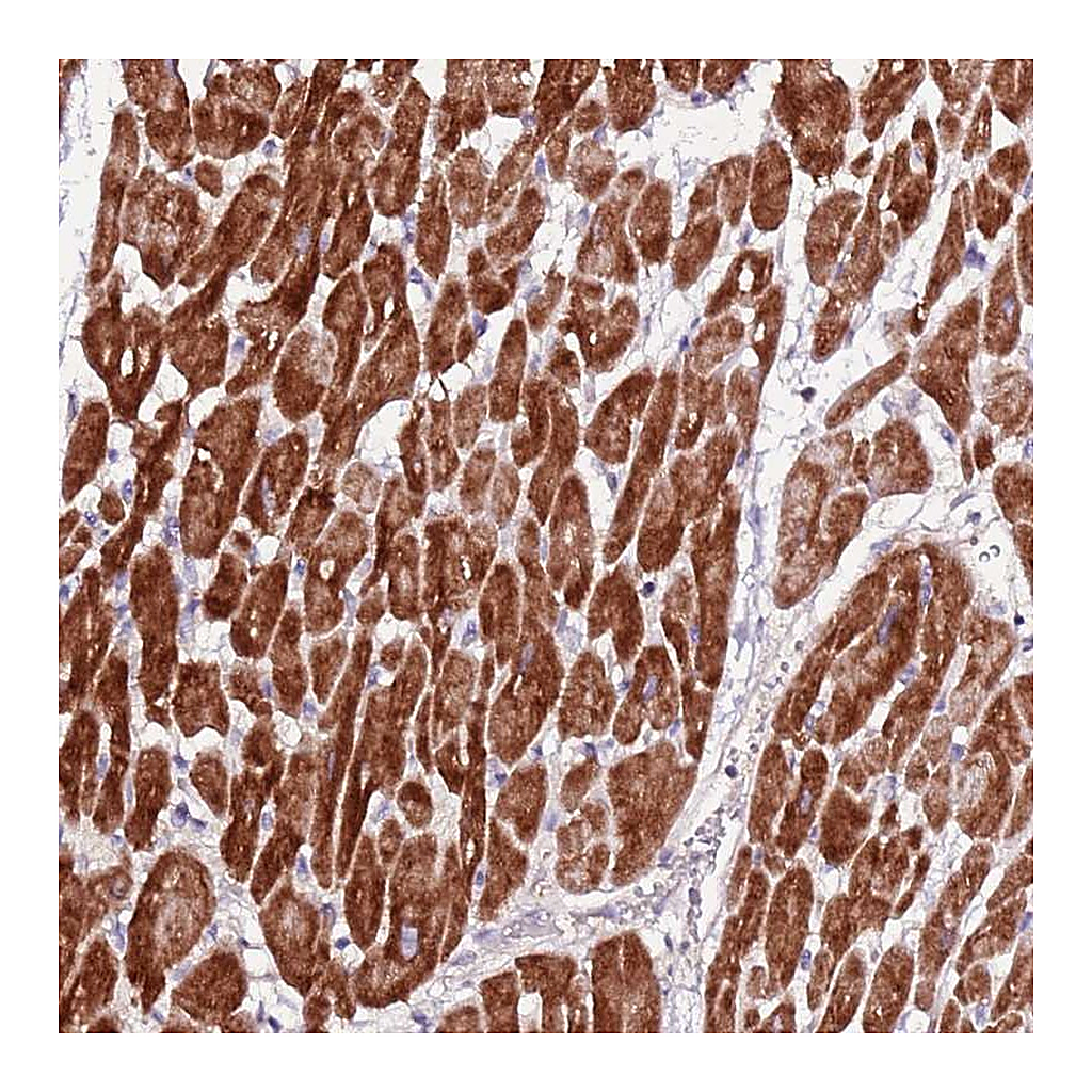 Atlas Antibodies Anti-ART5 Antibody