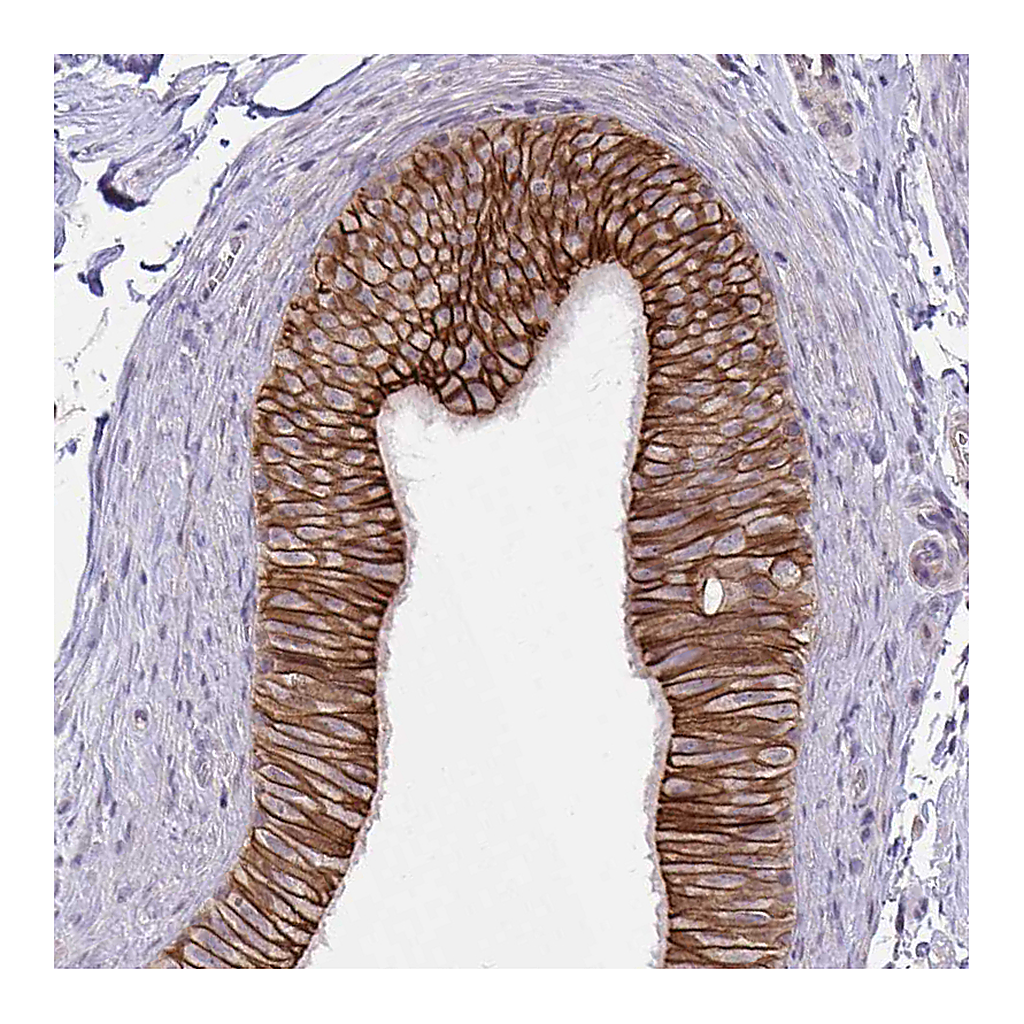 Atlas Antibodies Anti-ARVCF Antibody