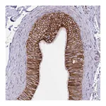 Atlas Antibodies Anti-ARVCF Antibody