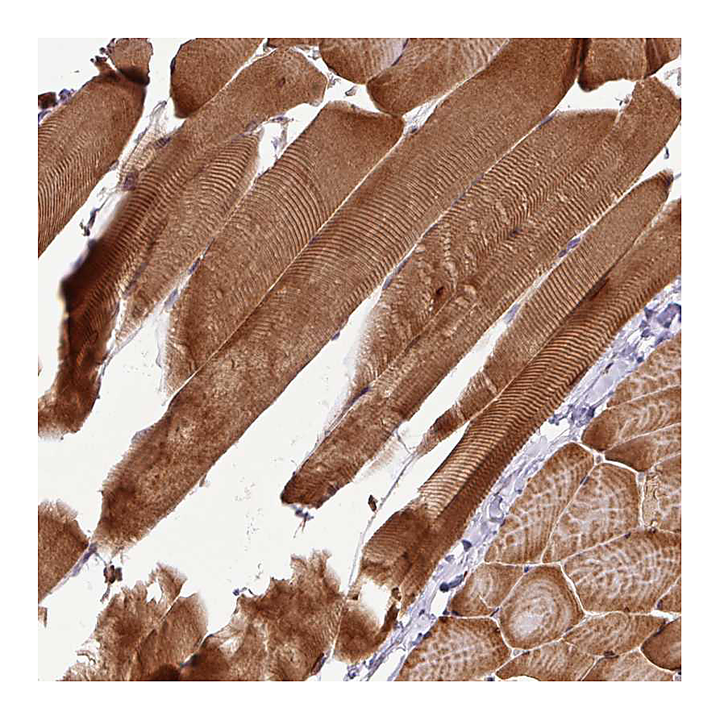 Atlas Antibodies Anti-ART1 Antibody