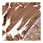 Atlas Antibodies Anti-ART1 Antibody