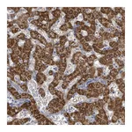 Atlas Antibodies Anti-ASB12 Antibody