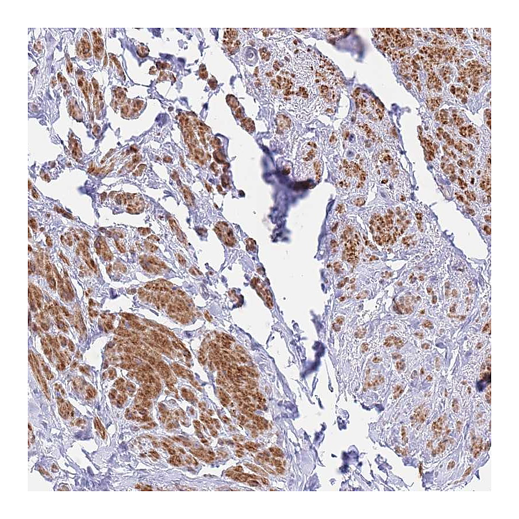 Atlas Antibodies Anti-ASAP3 Antibody