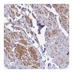 Atlas Antibodies Anti-ASAP3 Antibody