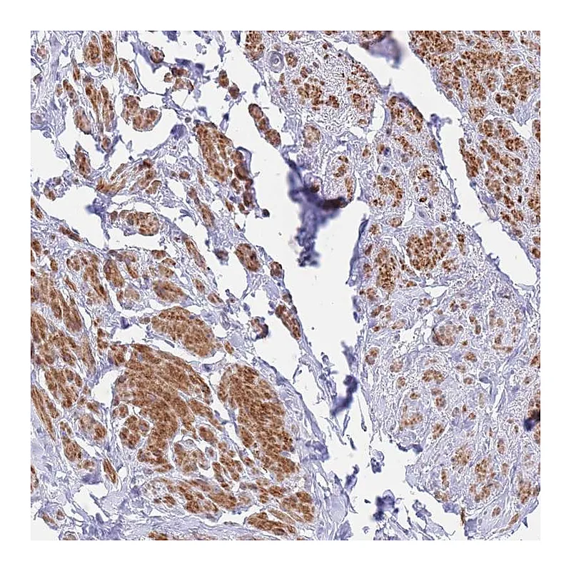 Atlas Antibodies Anti-ASAP3 Antibody