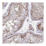 Atlas Antibodies Anti-ASAP1 Antibody