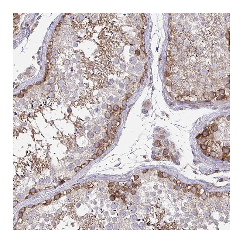 Atlas Antibodies Anti-ASAP1 Antibody
