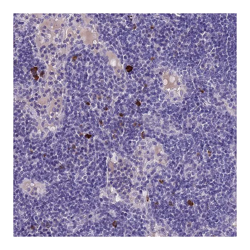 Atlas Antibodies Anti-ASAP3 Antibody