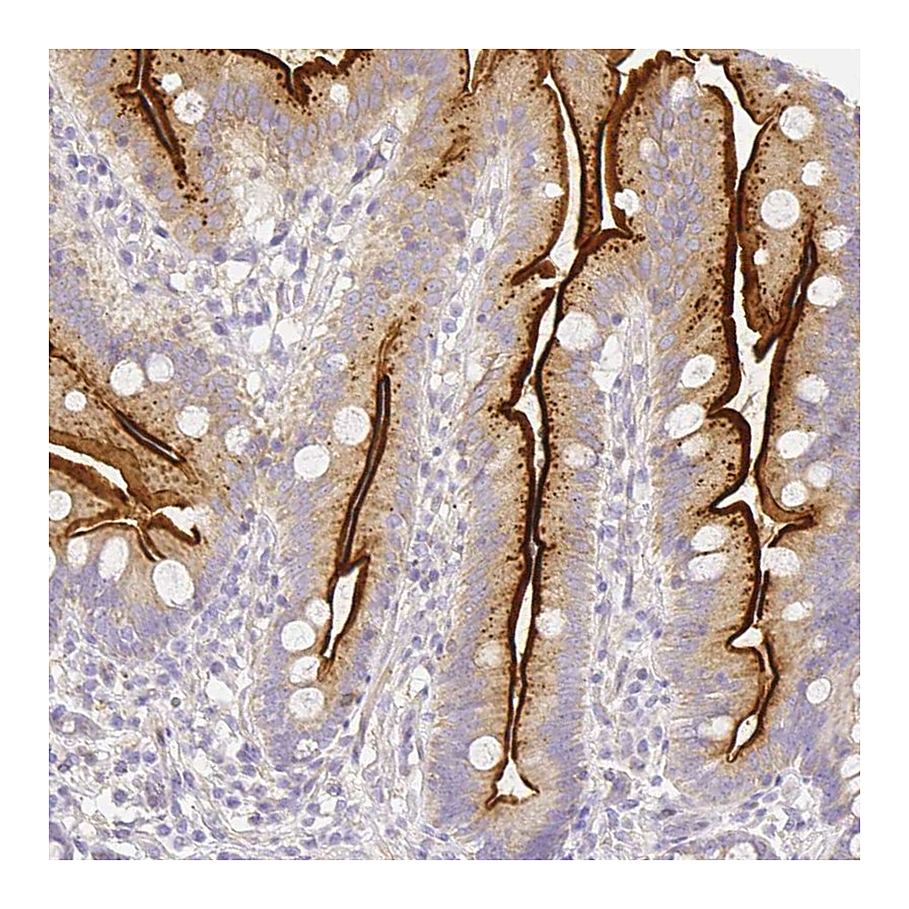 Atlas Antibodies Anti-ASAH2 Antibody