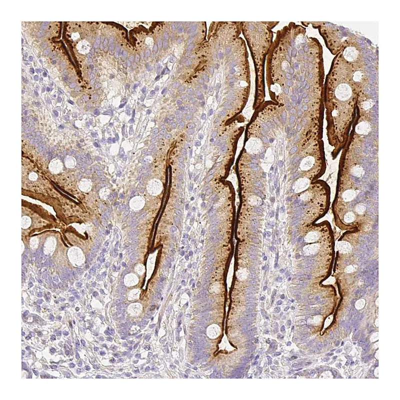 Atlas Antibodies Anti-ASAH2 Antibody