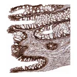 Atlas Antibodies Anti-ASAP1 Antibody