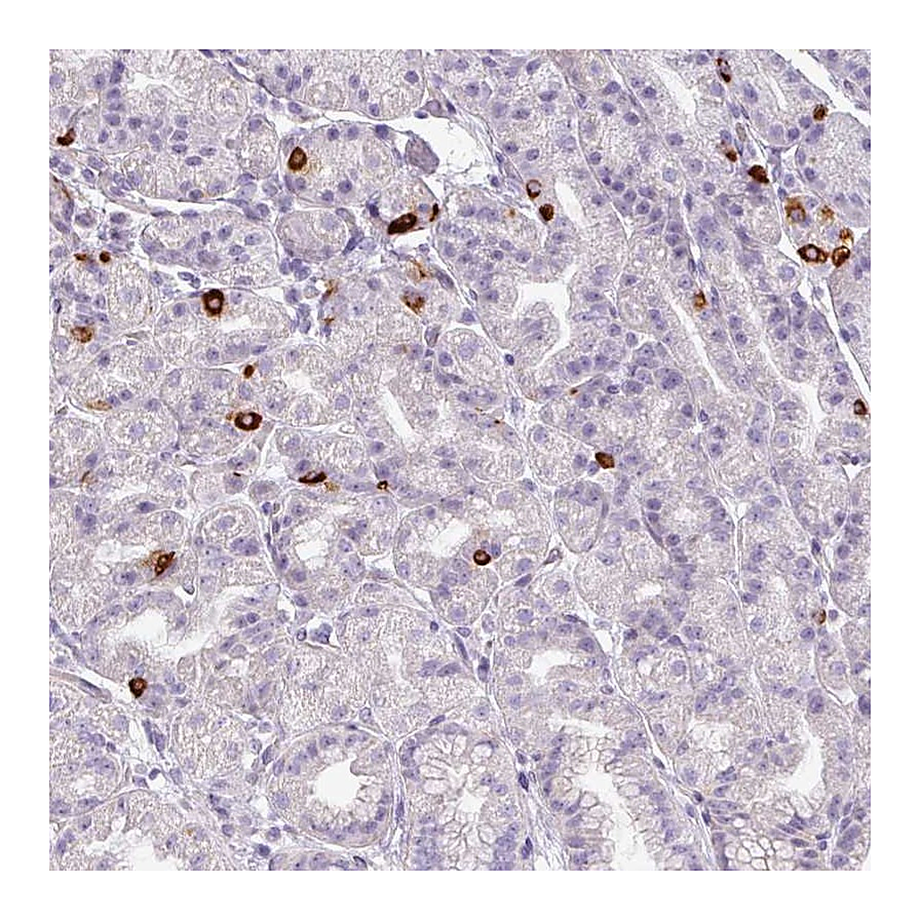 Atlas Antibodies Anti-ASB1 Antibody