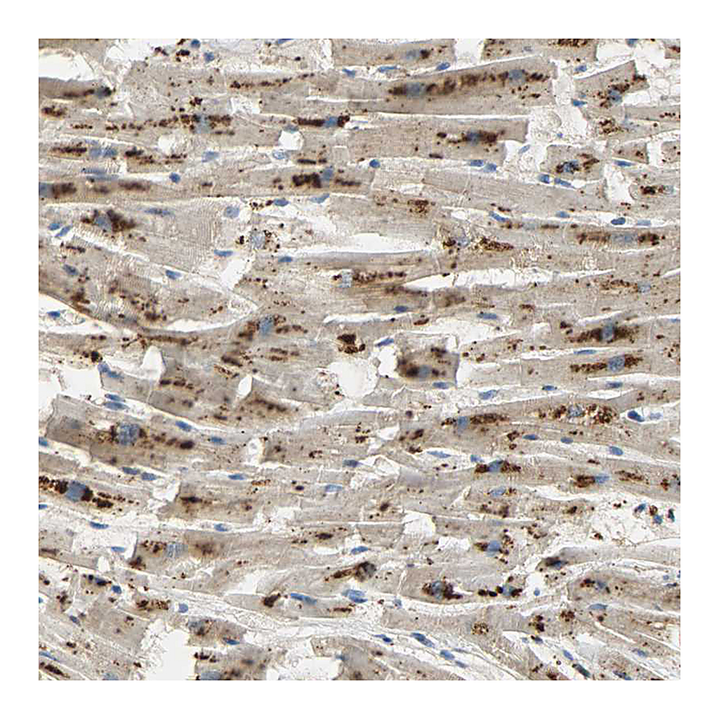 Atlas Antibodies Anti-ASAH1 Antibody