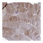 Atlas Antibodies Anti-ASB16 Antibody
