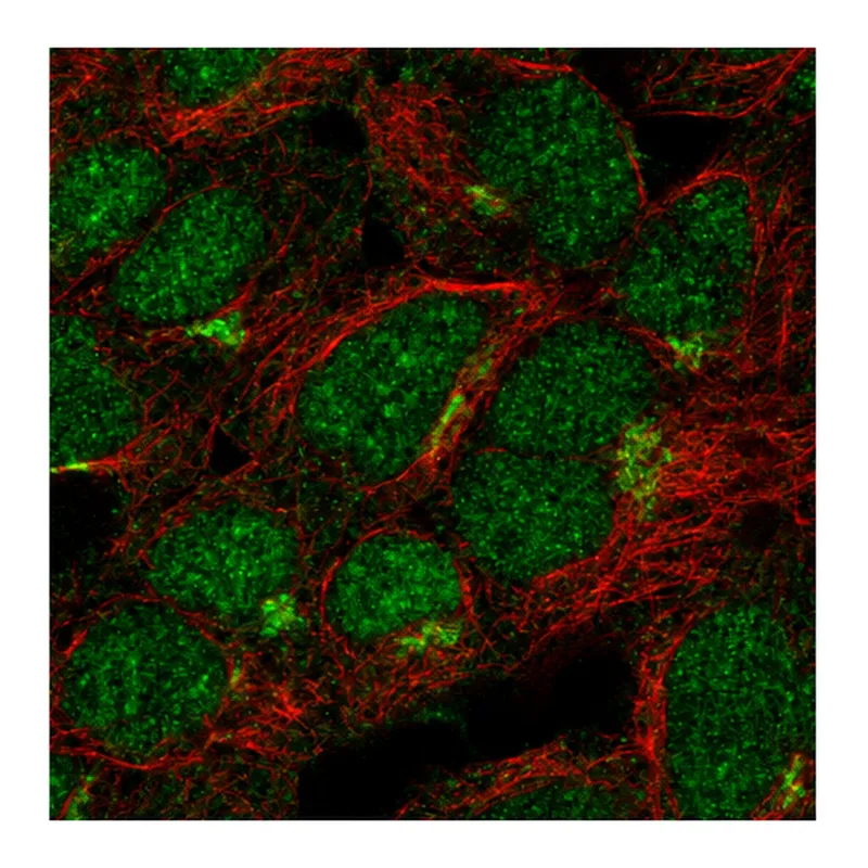 Atlas Antibodies Anti-ASB13 Antibody