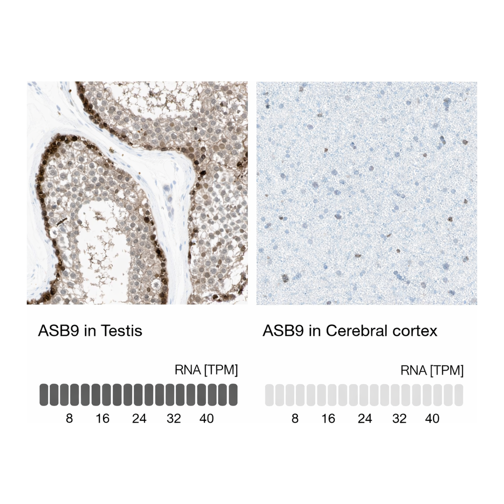 Atlas Antibodies Anti-ASB9 Antibody