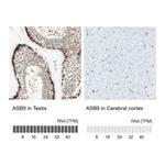 Atlas Antibodies Anti-ASB9 Antibody