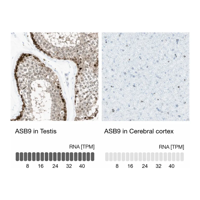 Atlas Antibodies Anti-ASB9 Antibody