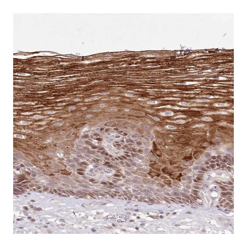 Atlas Antibodies Anti-ASCC1 Antibody
