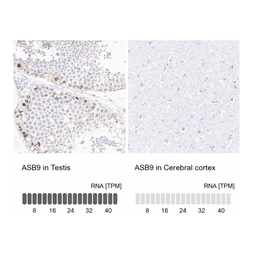 Atlas Antibodies Anti-ASB9 Antibody